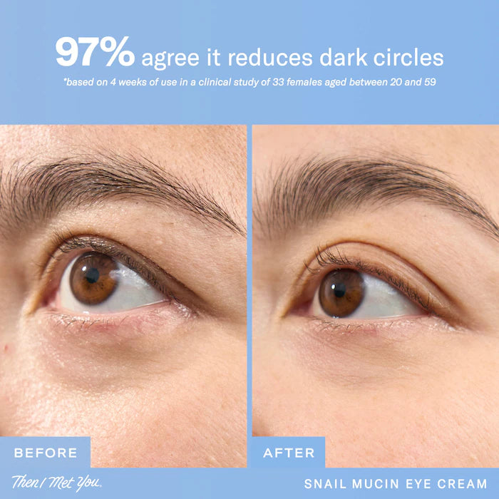 Snail Mucin Firming And Brightening Korean Eye Cream With Volufiline, Peptides, & Collagen For Fine Lines & Wrinkles