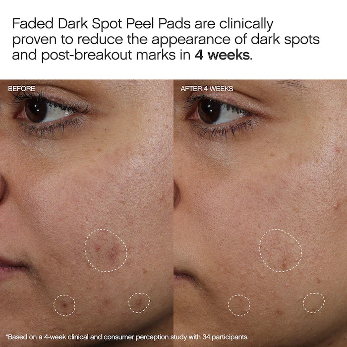 Faded Brightening Peel Pads For Dark Spots, Discoloration & Uneven Skin Tone