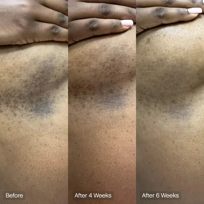 Faded Brightening & Cleansing Body Bar For Uneven Skin Tone