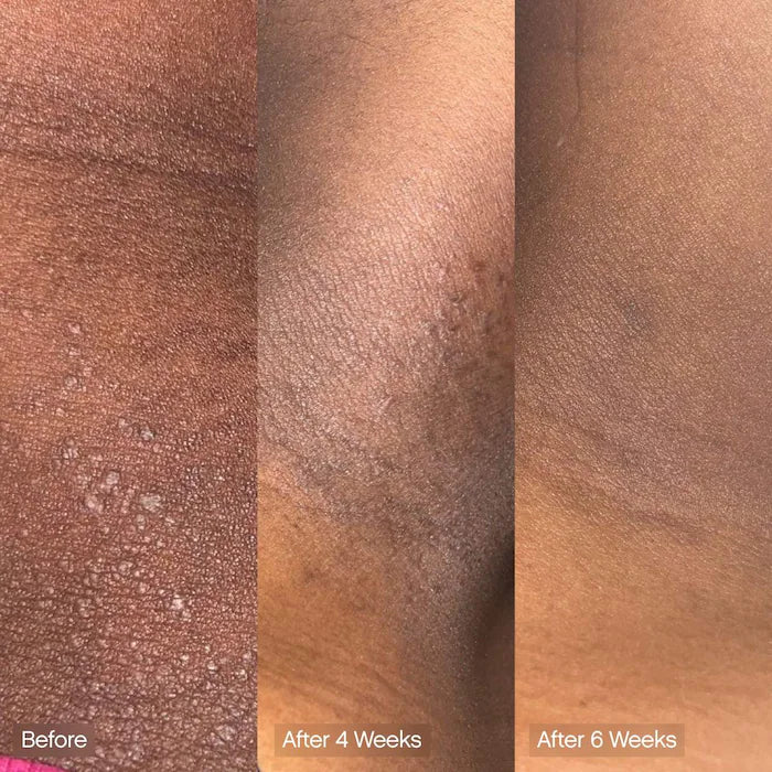 Faded Brightening & Cleansing Body Bar For Uneven Skin Tone