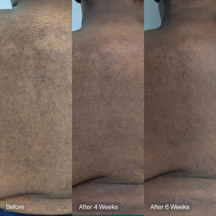 Faded Brightening & Cleansing Body Bar For Uneven Skin Tone