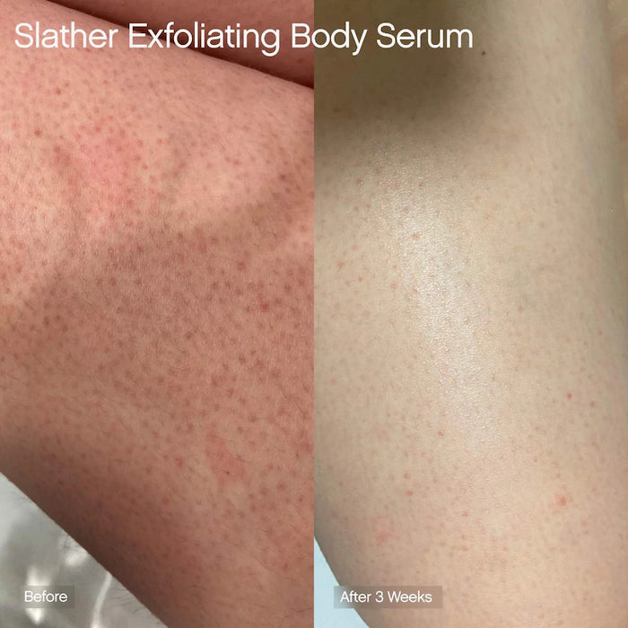 Slather Exfoliating Body Serum With Retinol And AHAs