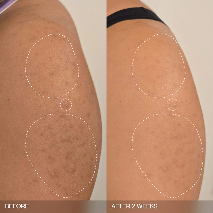 Slather Exfoliating & Smoothing Bar - For Soft Skin