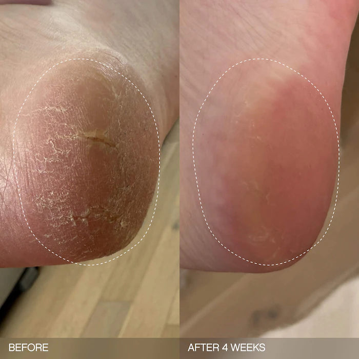 Slather Exfoliating & Smoothing Bar - For Soft Skin