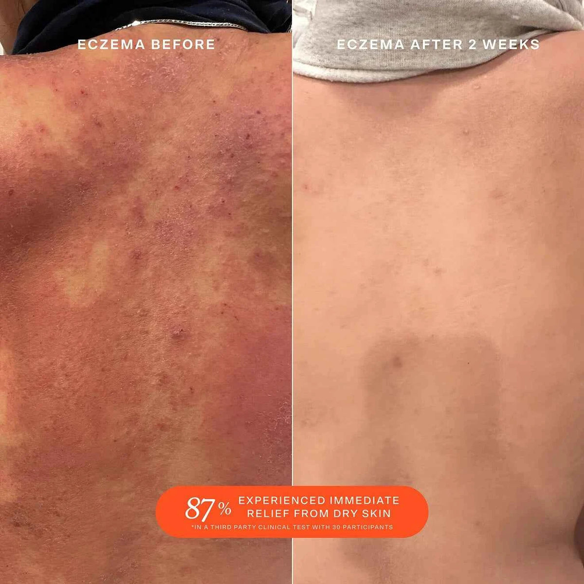 SOS Daily Rescue Facial Spray