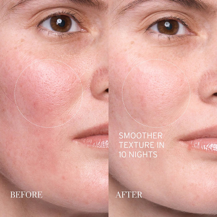 Lotus AHA Resurfacing Gentle Serum