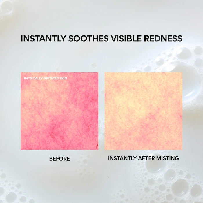 Green Tea Korean Ceramide Mist With Hyaluronic Acid For Redness & Soothing