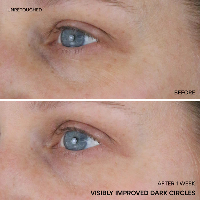 Vitamin C Niacinamide Brightening Eye Serum For Dark Circles