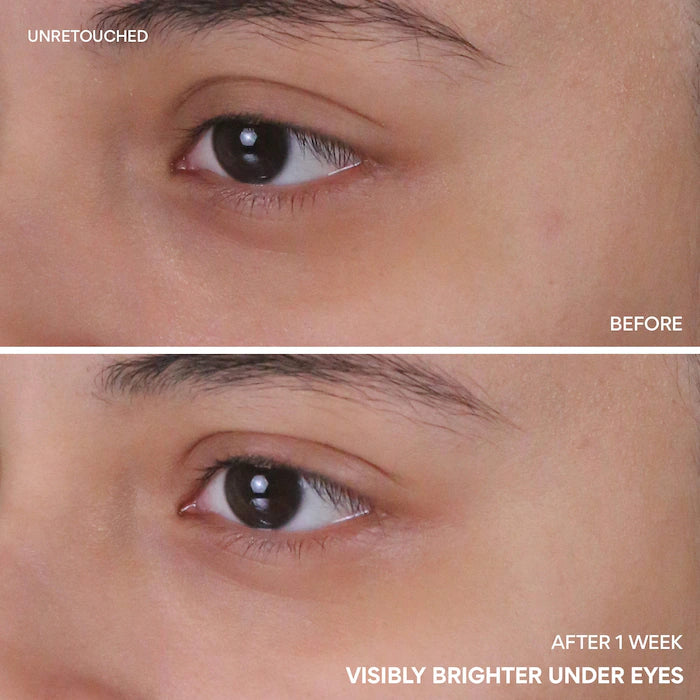 Vitamin C Niacinamide Brightening Eye Serum For Dark Circles