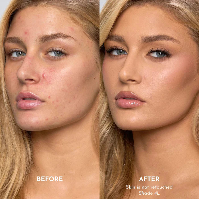 Forget The Filler Skin-Plumping Line-Smoothing Foundation