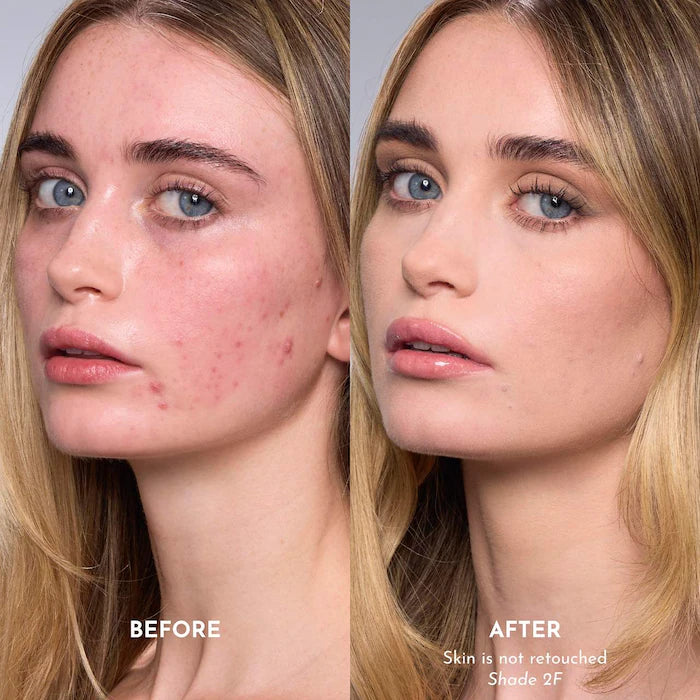 Forget The Filler Skin-Plumping Line-Smoothing Foundation
