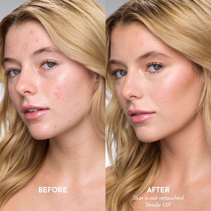 Forget The Filler Skin-Plumping Line-Smoothing Foundation