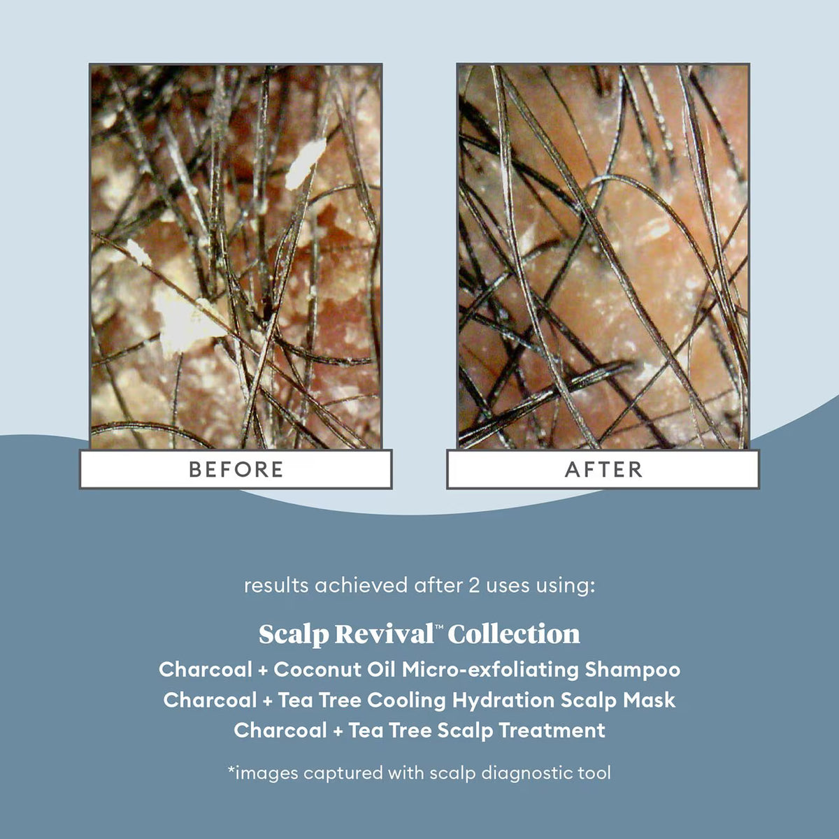 Scalp Revival™ Charcoal + Coconut Oil Micro-Exfoliating Shampoo - Azora Beauty